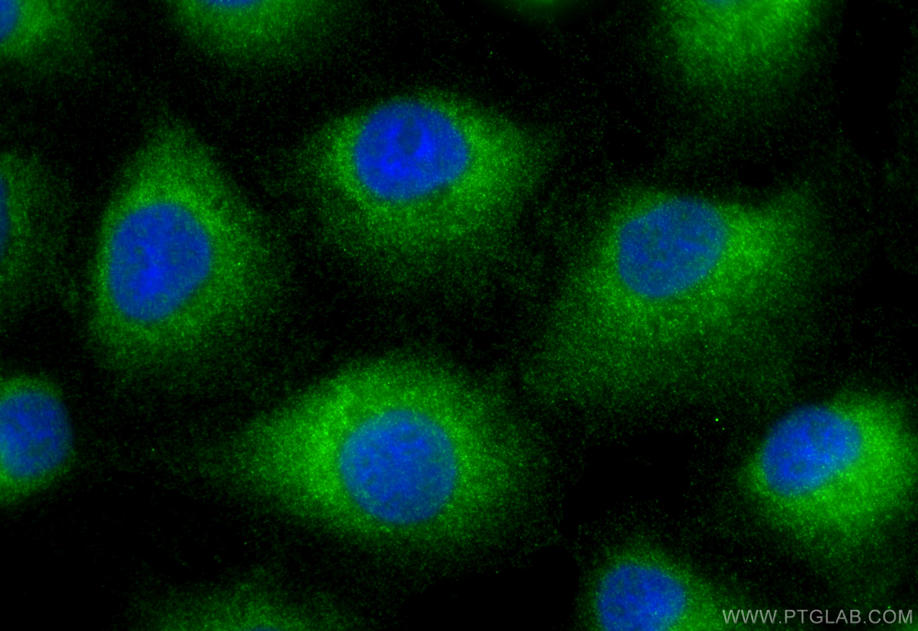 Immunofluorescence (IF) / fluorescent staining of A549 cells using SHKBP1 Polyclonal antibody (12703-1-AP)