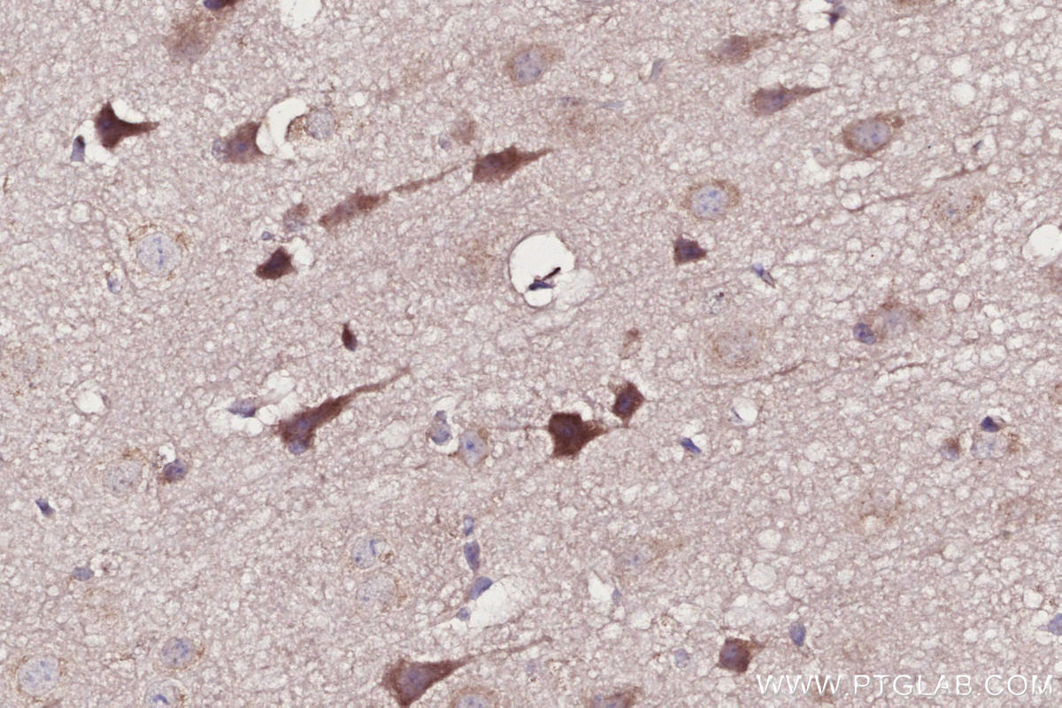 Immunohistochemistry (IHC) staining of mouse brain tissue using SHKBP1 Polyclonal antibody (12703-1-AP)