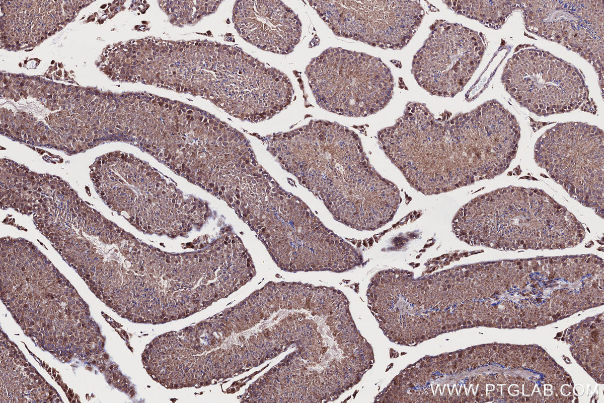Immunohistochemistry (IHC) staining of mouse testis tissue using SHKBP1 Polyclonal antibody (12703-1-AP)