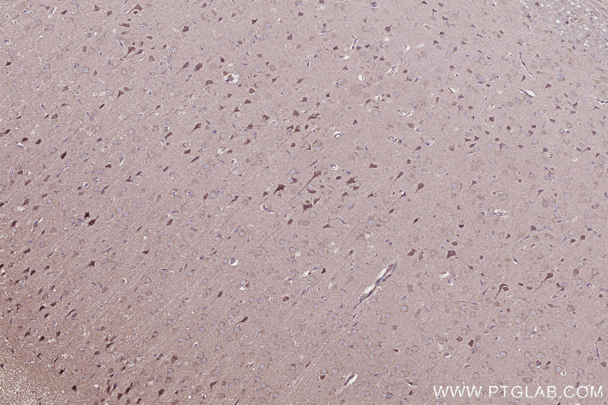 Immunohistochemistry (IHC) staining of rat brain tissue using SHKBP1 Polyclonal antibody (12703-1-AP)
