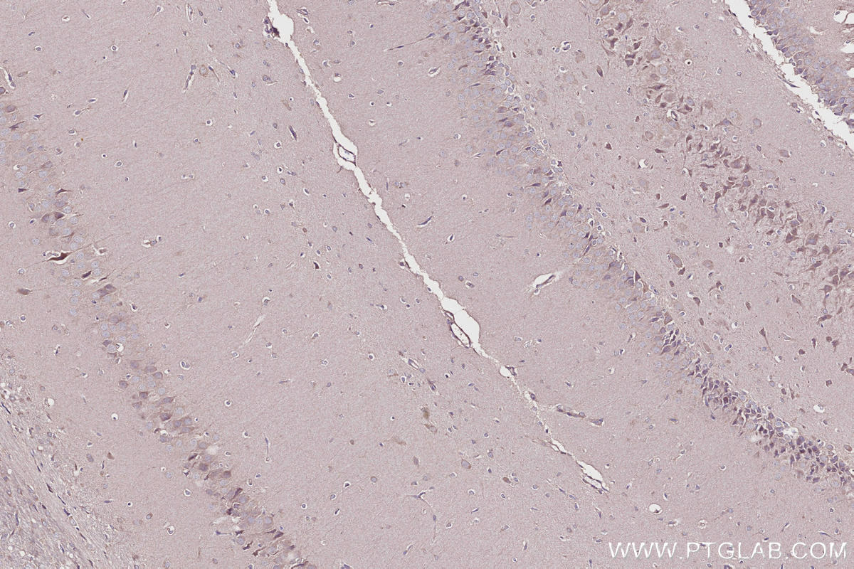 Immunohistochemistry (IHC) staining of rat brain tissue using SHKBP1 Polyclonal antibody (12703-1-AP)