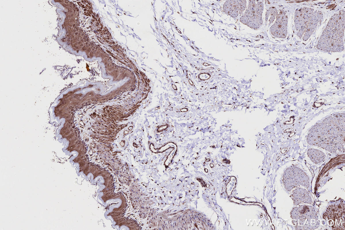 Immunohistochemistry (IHC) staining of rat stomach tissue using SHKBP1 Polyclonal antibody (12703-1-AP)