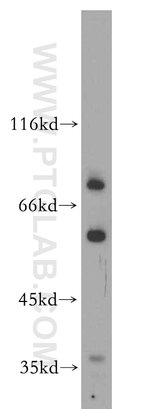 Western Blot (WB) analysis of A431 cells using SHKBP1 Polyclonal antibody (12703-1-AP)