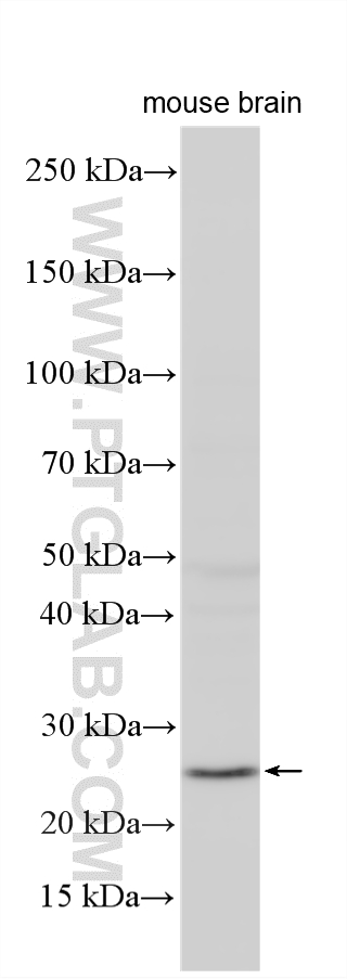 WB analysis using 24347-1-AP Western Blot (WB) analysis of various lysates using SHLD1 Polyclonal antibody (24347-1-AP)