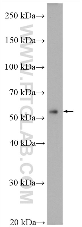Western Blot (WB) analysis of HepG2 cells using SHMT1 Polyclonal antibody (14149-1-AP)