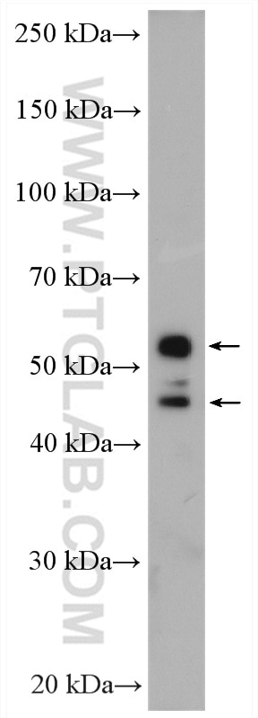Western Blot (WB) analysis of HeLa cells using SHMT1 Polyclonal antibody (14149-1-AP)