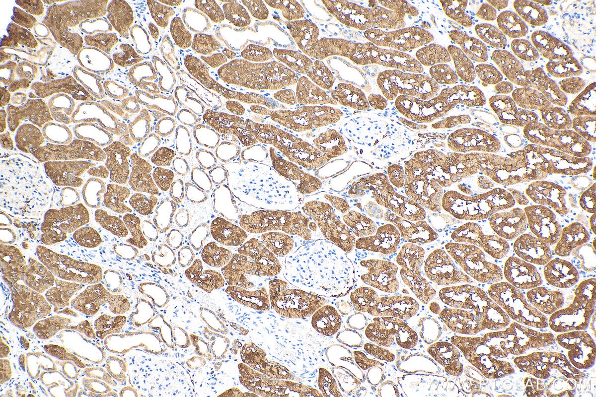 Immunohistochemistry (IHC) staining of human kidney tissue using SHMT1 Polyclonal antibody (30192-1-AP)
