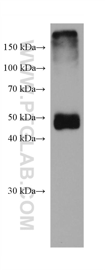 Western Blot (WB) analysis of rabbit liver tissue using SHMT1 Monoclonal antibody (67963-1-Ig)