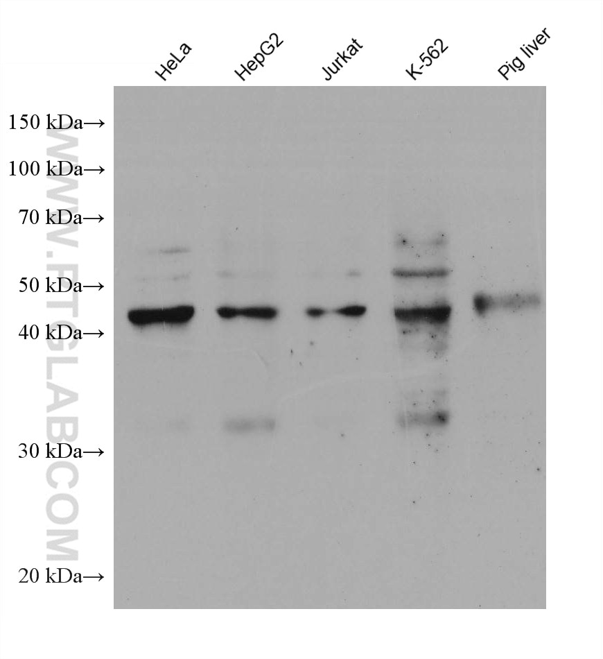 Western Blot (WB) analysis of various lysates using SHMT1 Monoclonal antibody (67963-1-Ig)