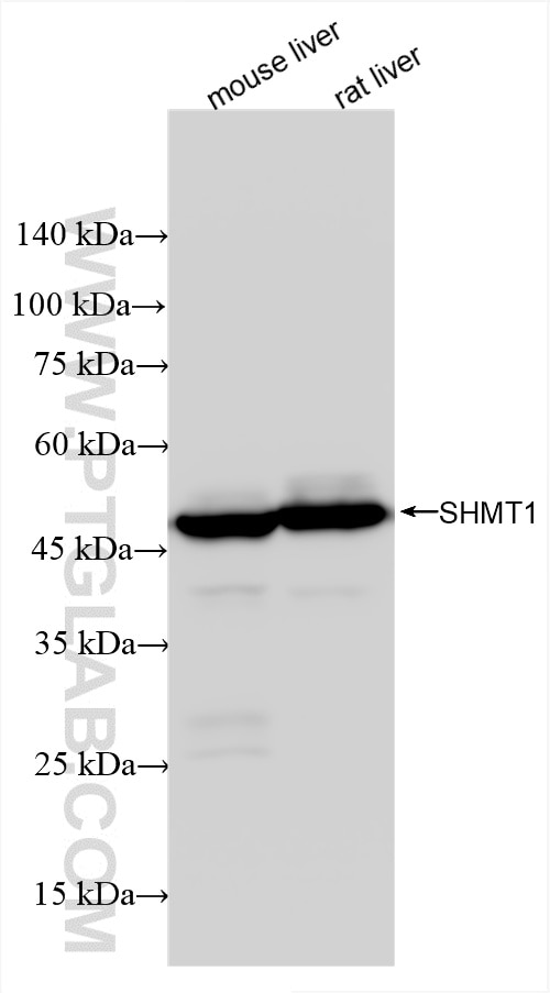 SHMT1