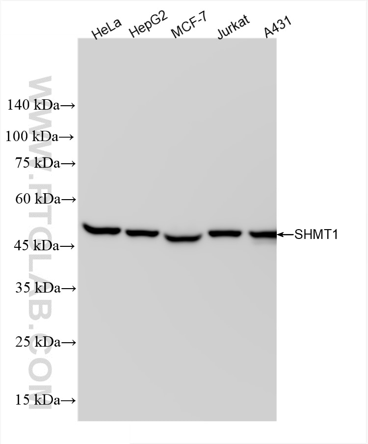 Western Blot (WB) analysis of various lysates using SHMT1 Recombinant antibody (85758-5-RR)