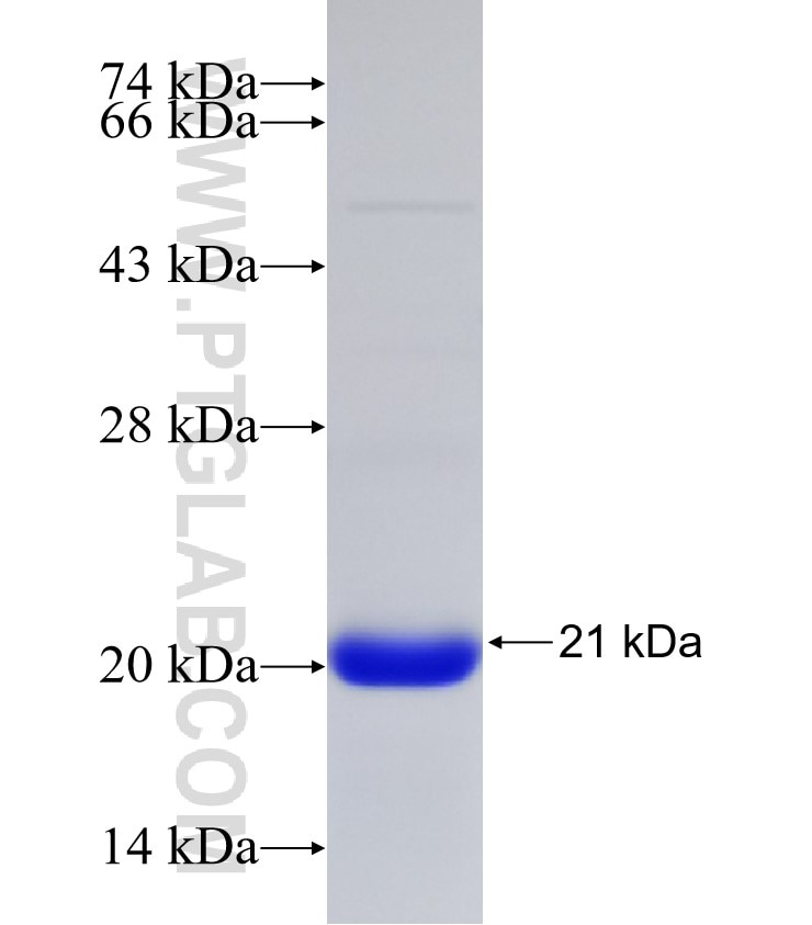 SHMT1 fusion protein Ag31269 SDS-PAGE