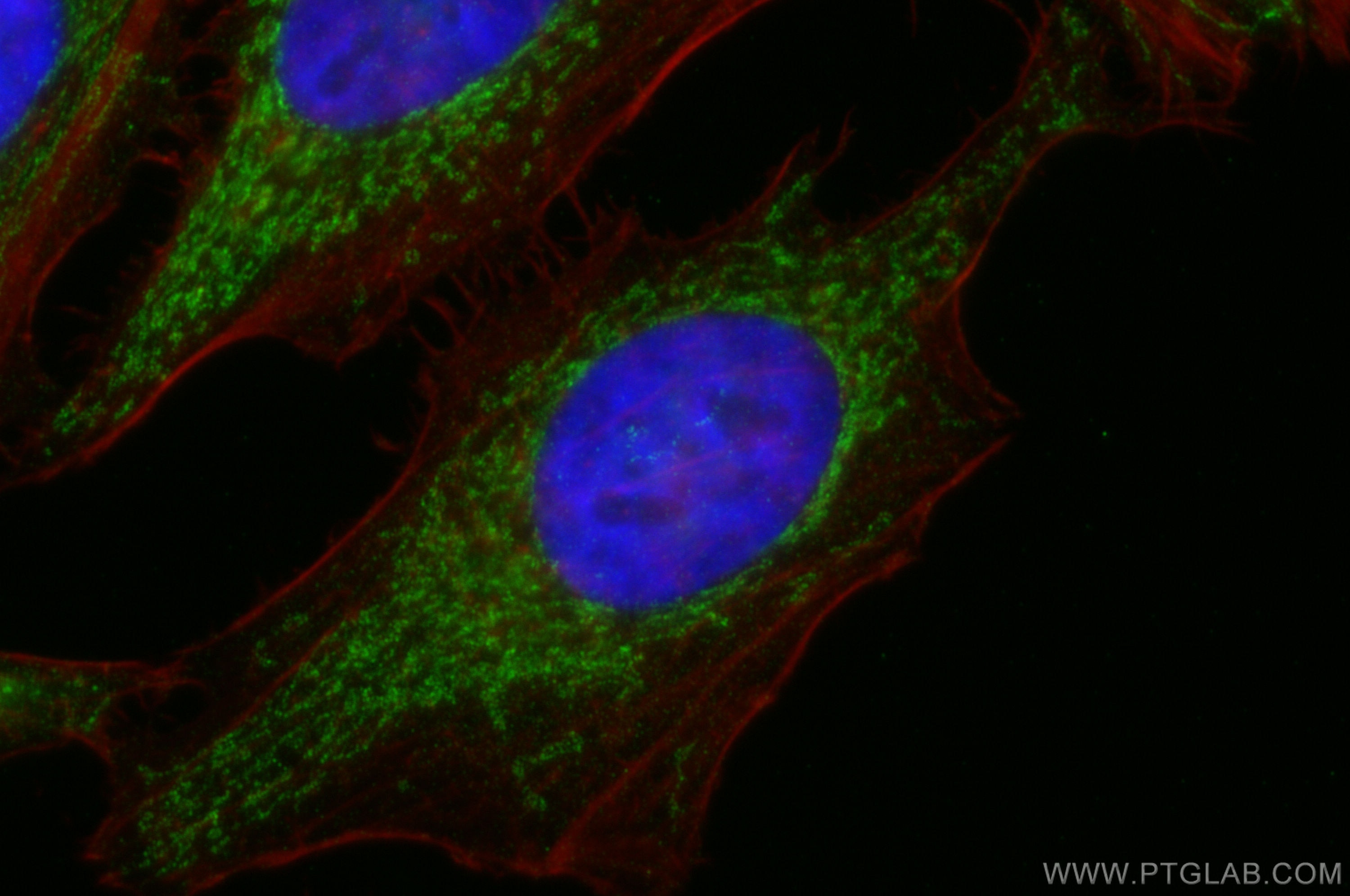 Immunofluorescence (IF) / fluorescent staining of HeLa cells using SHMT2 Polyclonal antibody (11099-1-AP)