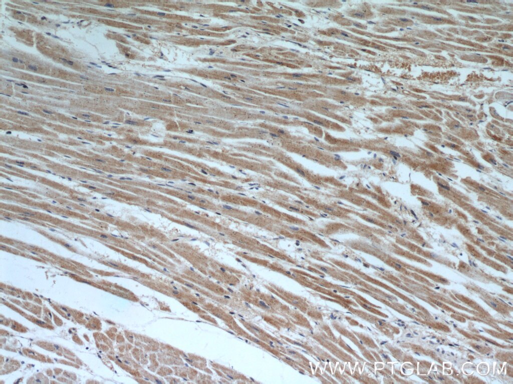 Immunohistochemistry (IHC) staining of human heart tissue using SHMT2 Polyclonal antibody (11099-1-AP)