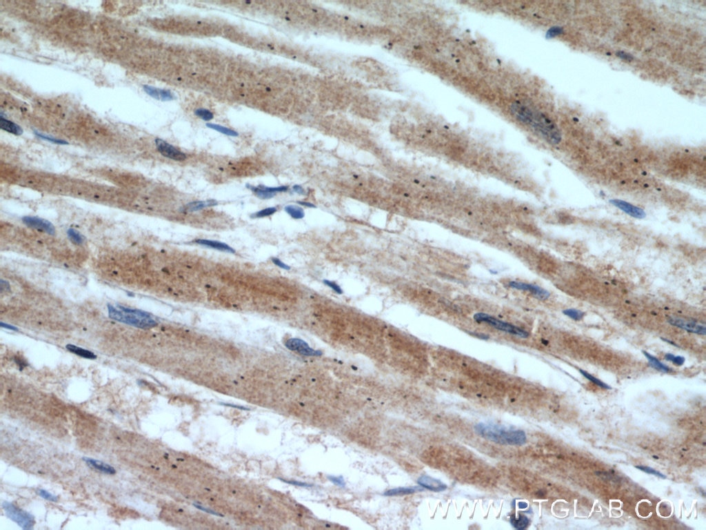 IHC staining of human heart using 11099-1-AP