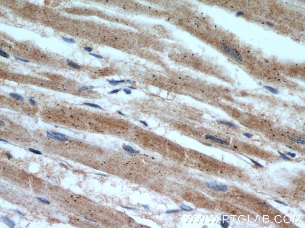 Immunohistochemistry (IHC) staining of human heart tissue using SHMT2 Polyclonal antibody (11099-1-AP)