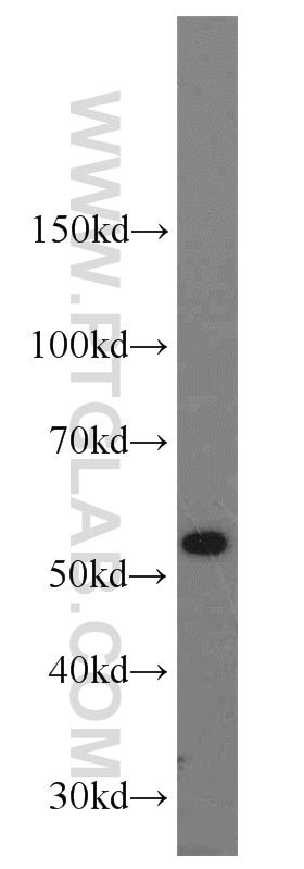 SHMT2 Polyclonal antibody