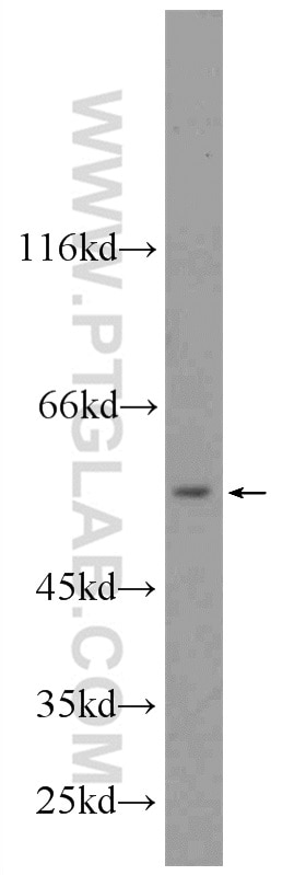 Western Blot (WB) analysis of mouse kidney tissue using SHMT2 Polyclonal antibody (11099-1-AP)