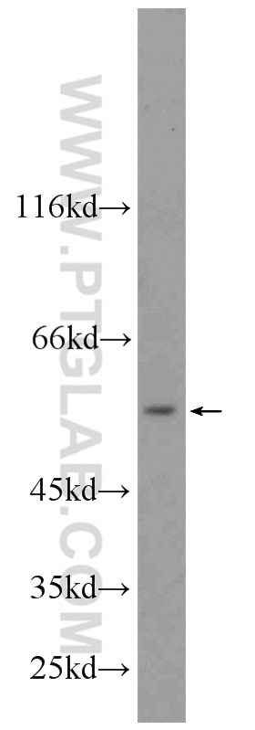 WB analysis of mouse kidney using 11099-1-AP