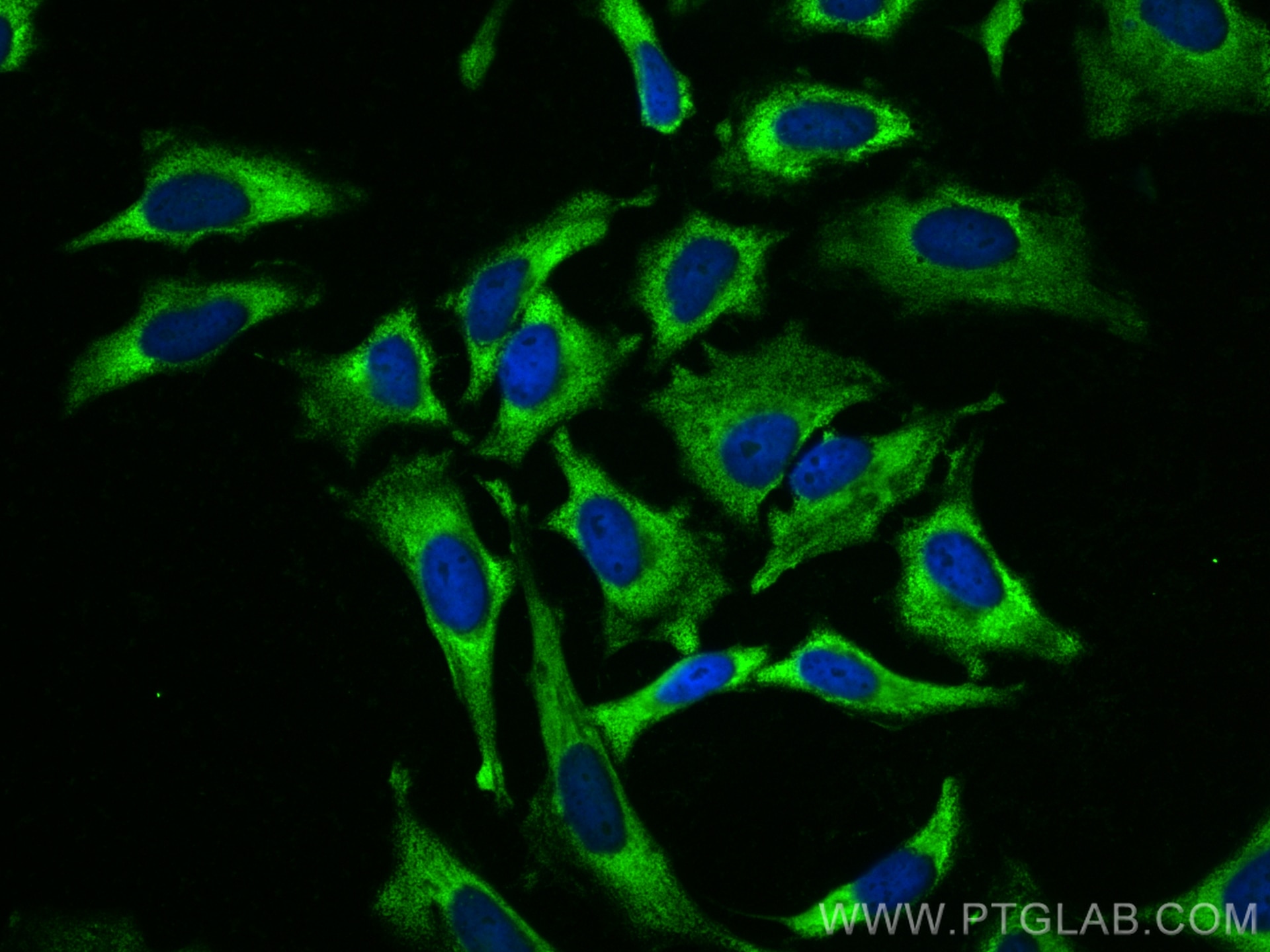 Immunofluorescence (IF) / fluorescent staining of HeLa cells using CoraLite® Plus 488-conjugated SHMT2 Monoclonal ant (CL488-67980)
