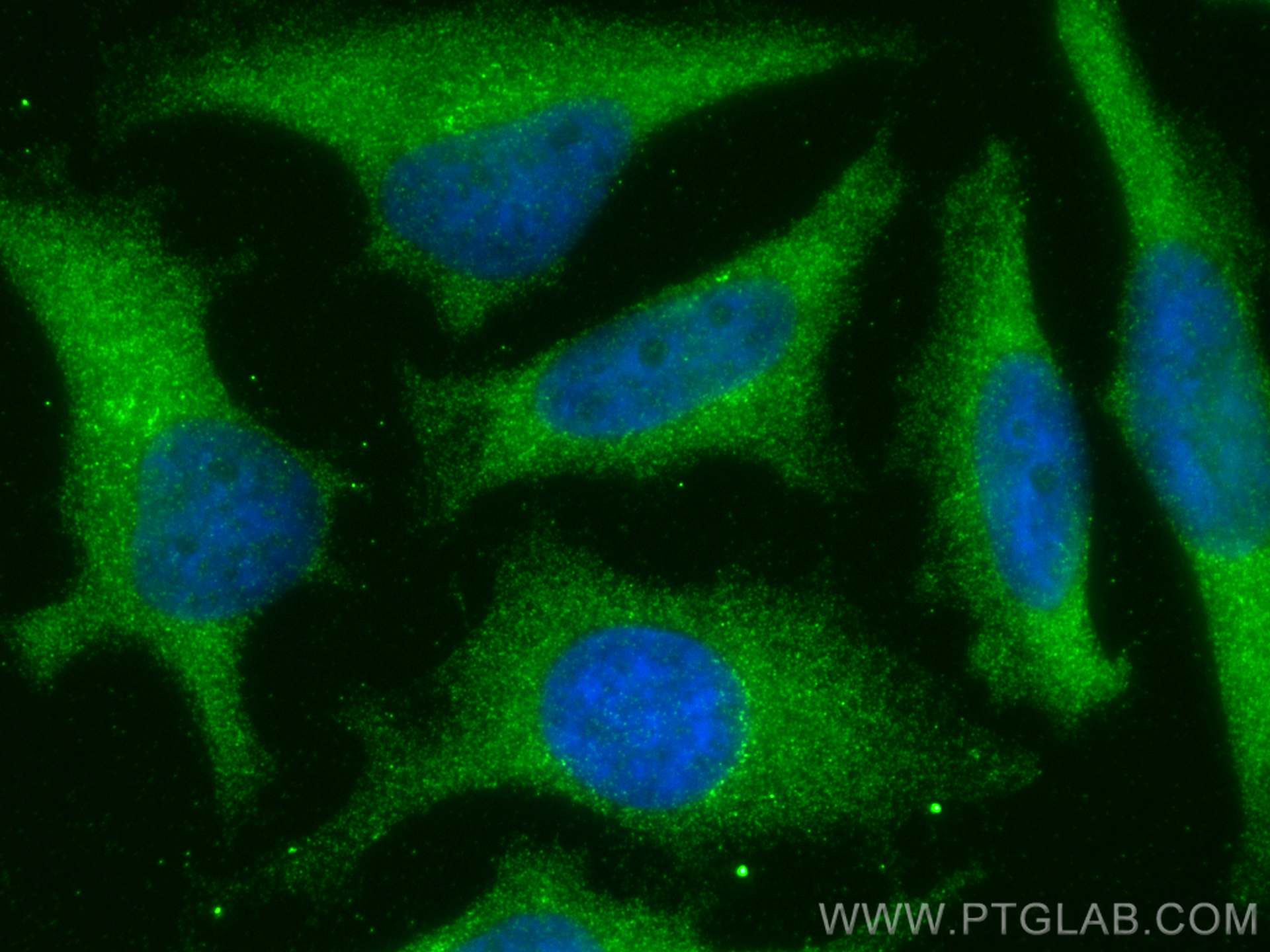 Immunofluorescence (IF) / fluorescent staining of HeLa cells using Sur-8 Polyclonal antibody (17561-1-AP)