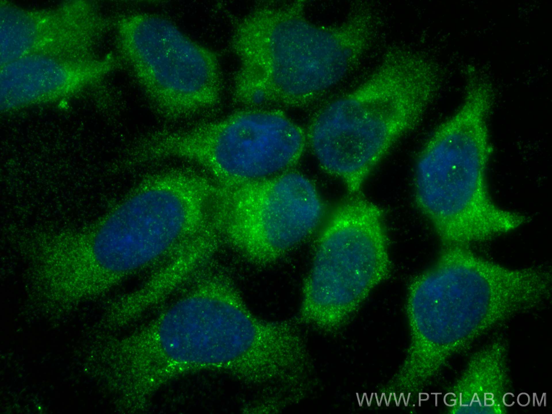 Immunofluorescence (IF) / fluorescent staining of MCF-7 cells using Sur-8 Polyclonal antibody (17561-1-AP)