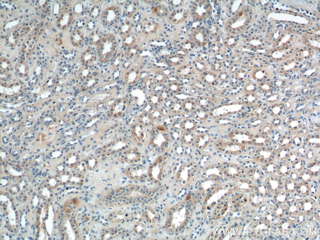 Immunohistochemistry (IHC) staining of human kidney tissue using Sur-8 Polyclonal antibody (17561-1-AP)