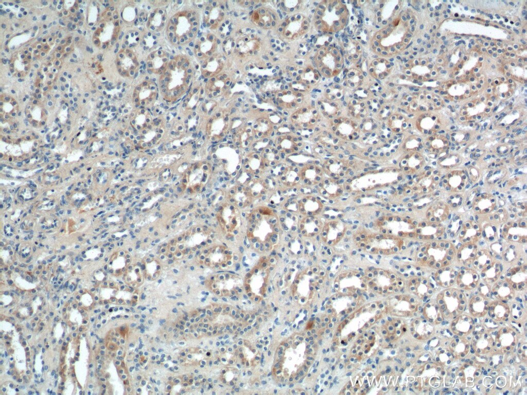 IHC staining of human kidney using 17561-1-AP