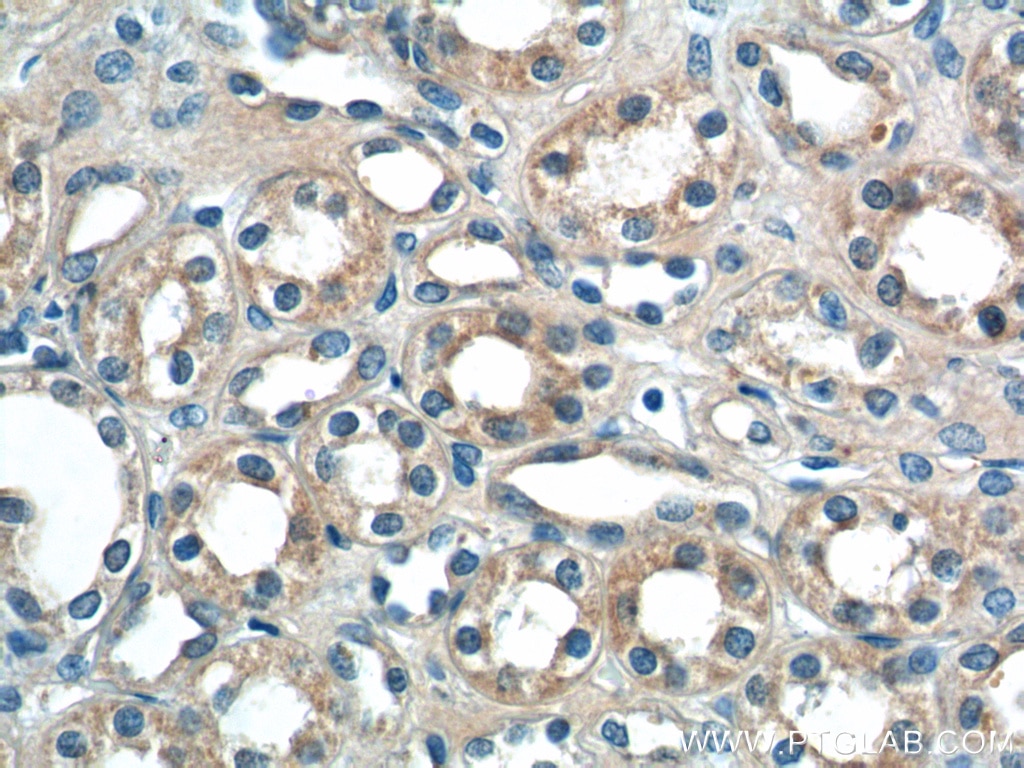 Immunohistochemistry (IHC) staining of human kidney tissue using Sur-8 Polyclonal antibody (17561-1-AP)