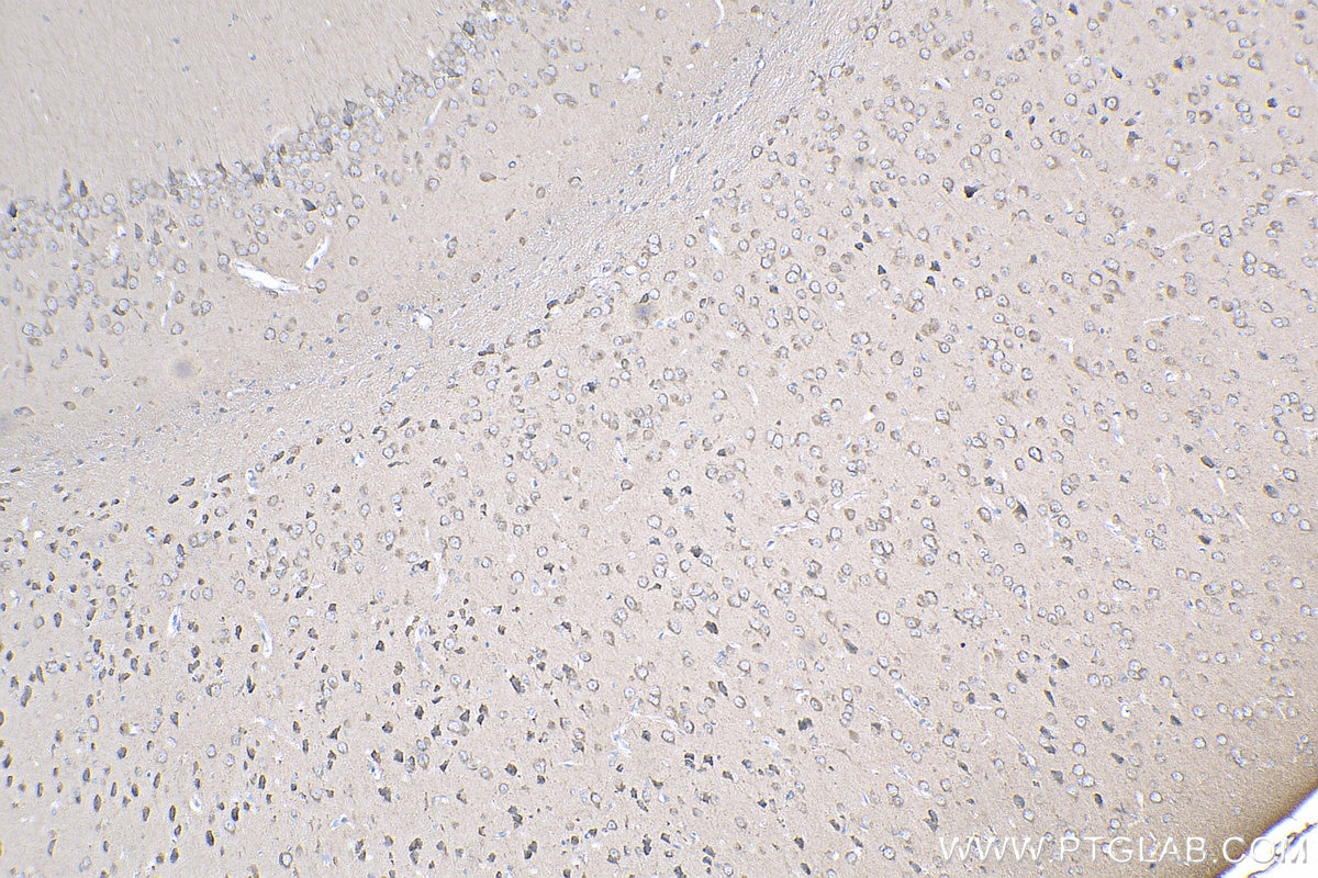Immunohistochemistry (IHC) staining of mouse brain tissue using Sur-8 Polyclonal antibody (17561-1-AP)