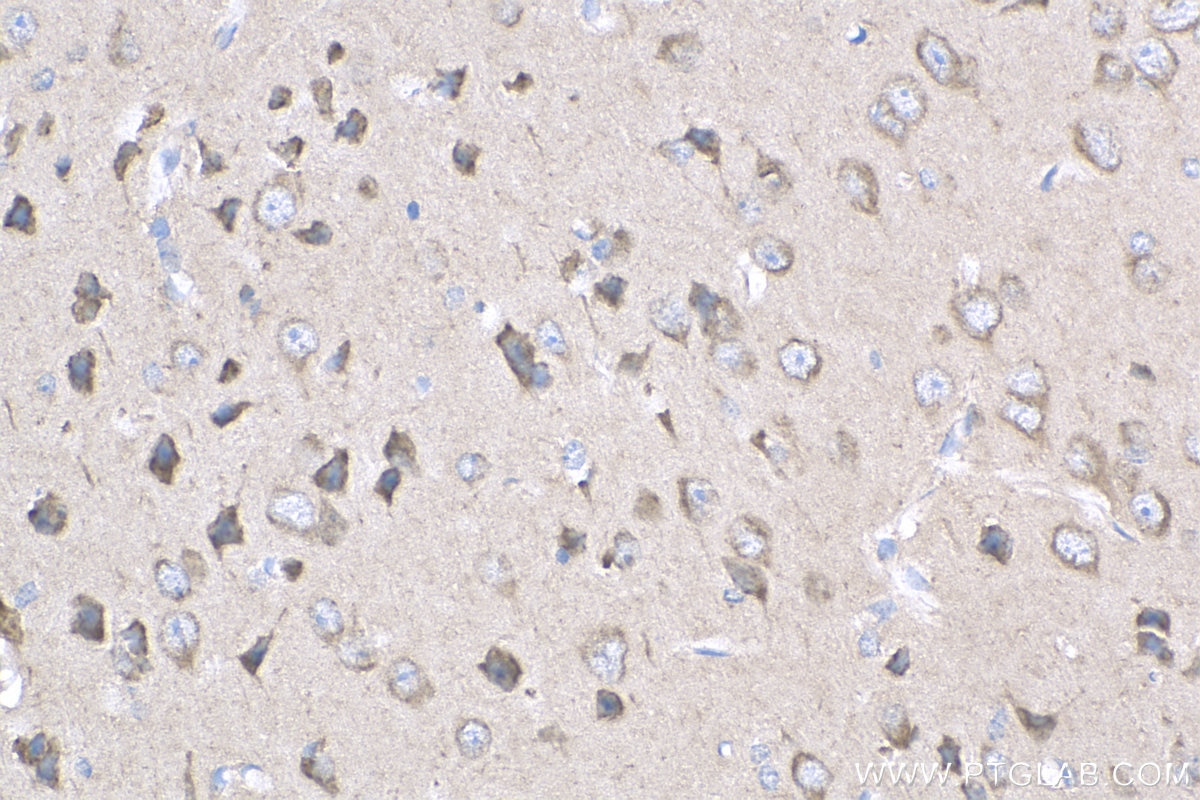 Immunohistochemistry (IHC) staining of mouse brain tissue using Sur-8 Polyclonal antibody (17561-1-AP)
