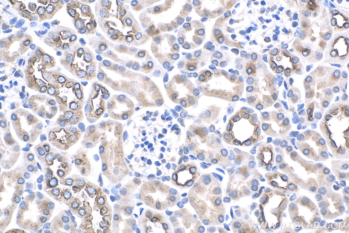 Immunohistochemistry (IHC) staining of mouse kidney tissue using Sur-8 Polyclonal antibody (17561-1-AP)