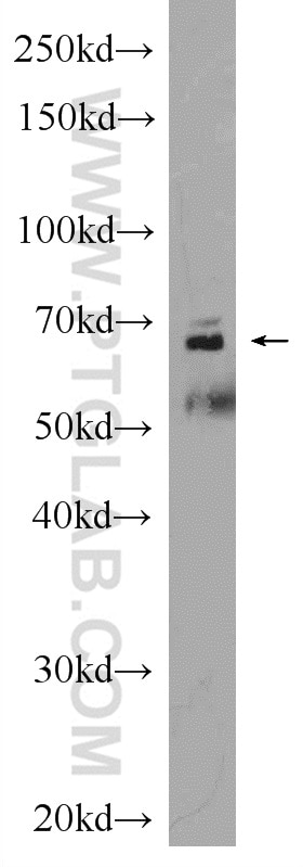 Western Blot (WB) analysis of mouse brain tissue using Sur-8 Polyclonal antibody (17561-1-AP)