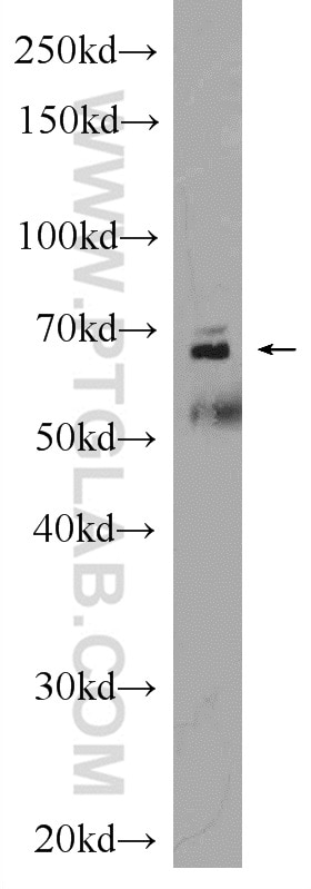 WB analysis of mouse brain using 17561-1-AP