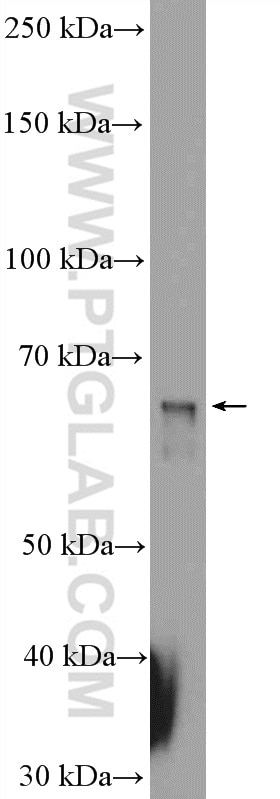 Western Blot (WB) analysis of rat testis tissue using Sur-8 Polyclonal antibody (17561-1-AP)