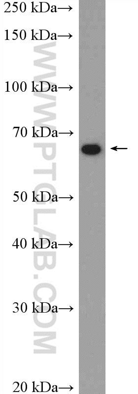 Western Blot (WB) analysis of Jurkat cells using Sur-8 Polyclonal antibody (17561-1-AP)