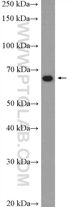WB analysis of Jurkat using 17561-1-AP