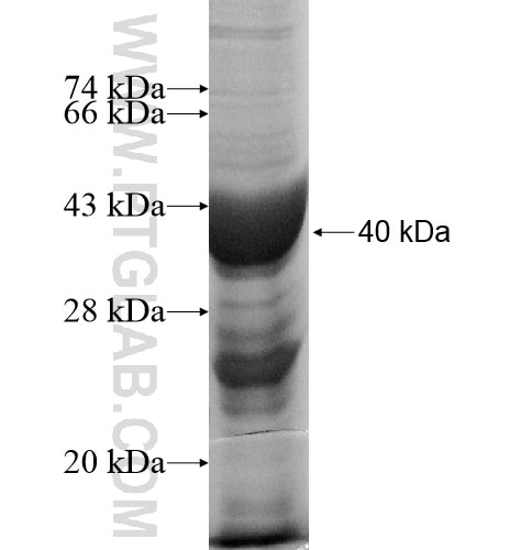 SHOC2 fusion protein Ag11665 SDS-PAGE