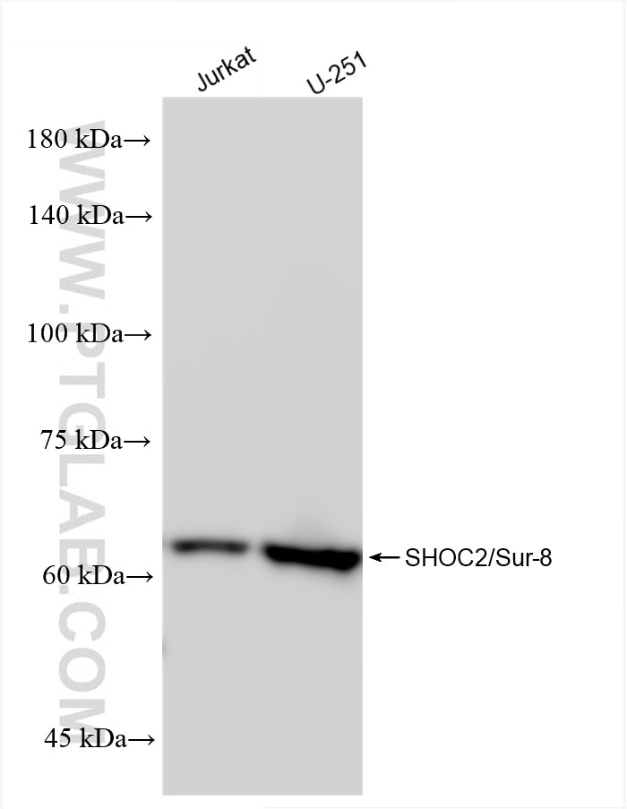 Western Blot (WB) analysis of various lysates using SHOC2/Sur-8 Recombinant antibody (84917-5-RR)