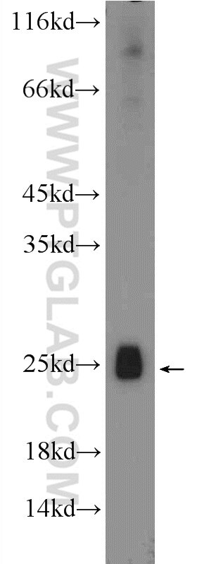 Western Blot (WB) analysis of fetal human brain tissue using SHOX Polyclonal antibody (25117-1-AP)