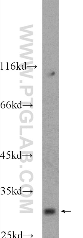 Western Blot (WB) analysis of mouse brain tissue using SHOX Polyclonal antibody (25117-1-AP)