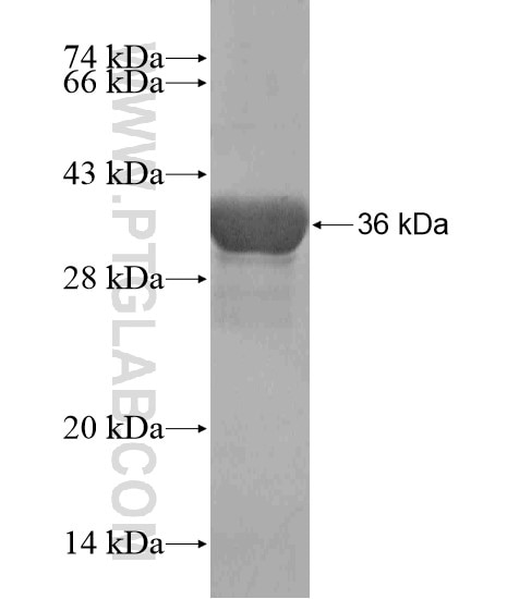 SHOX fusion protein Ag18930 SDS-PAGE