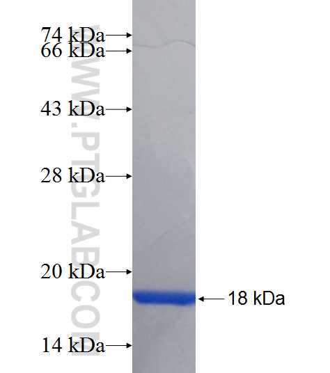 SHOX fusion protein Ag19027 SDS-PAGE