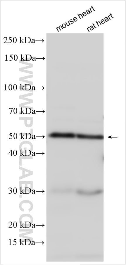 Western Blot (WB) analysis of various lysates using SHPK Polyclonal antibody (12441-1-AP)