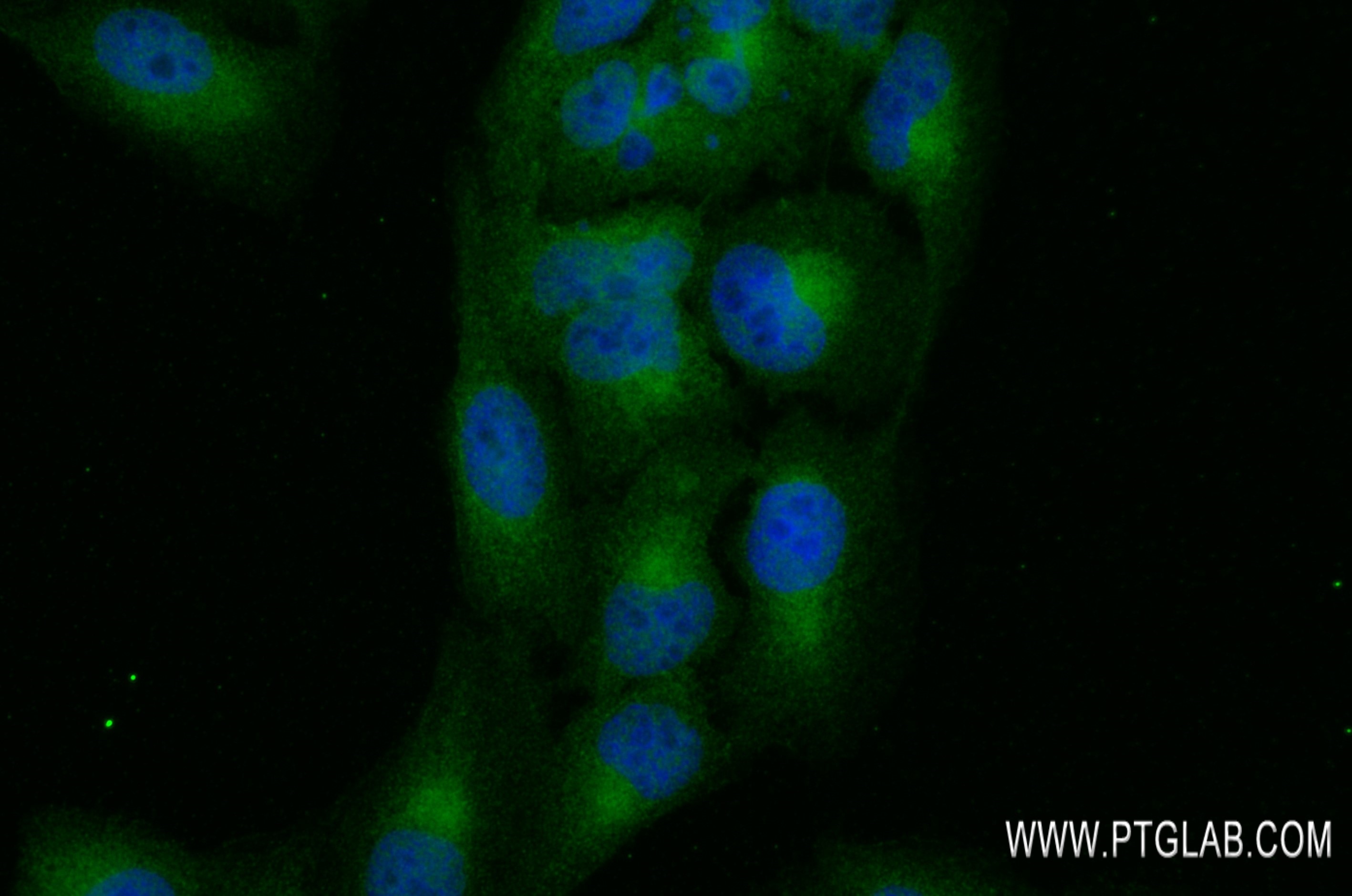 Immunofluorescence (IF) / fluorescent staining of U2OS cells using SHPK Recombinant antibody (82875-1-RR)