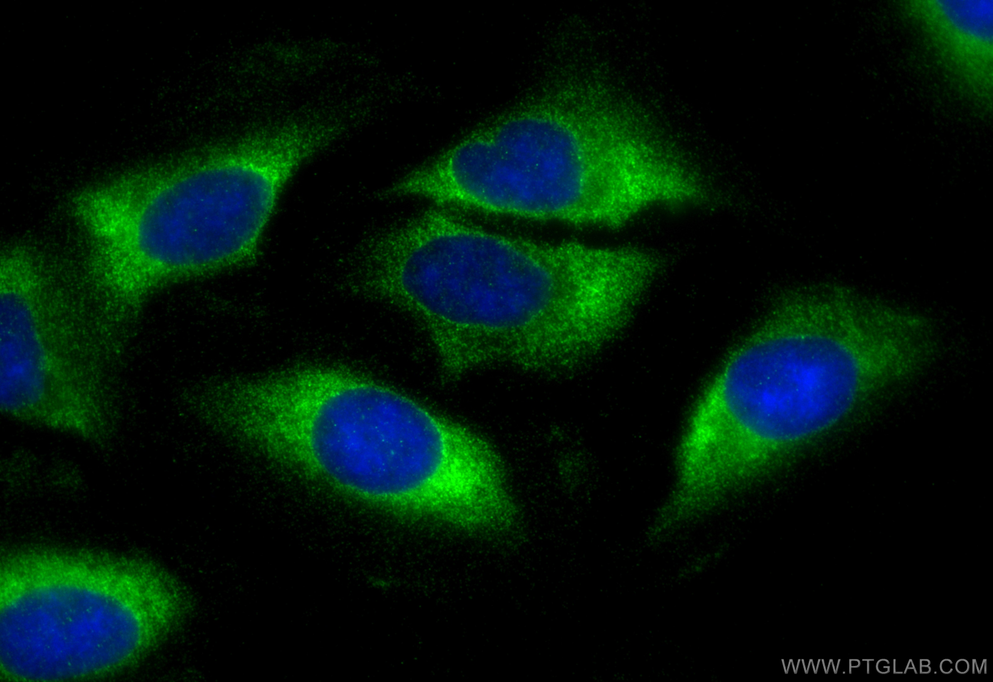 Immunofluorescence (IF) / fluorescent staining of U2OS cells using SHPK Recombinant antibody (82875-1-RR)