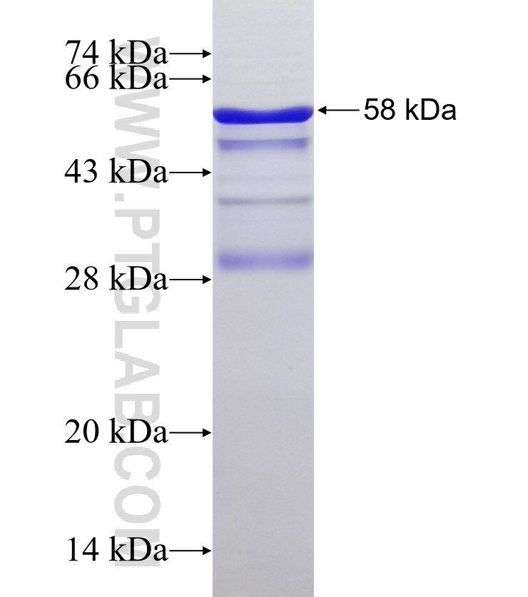 SHPK fusion protein Ag3150 SDS-PAGE