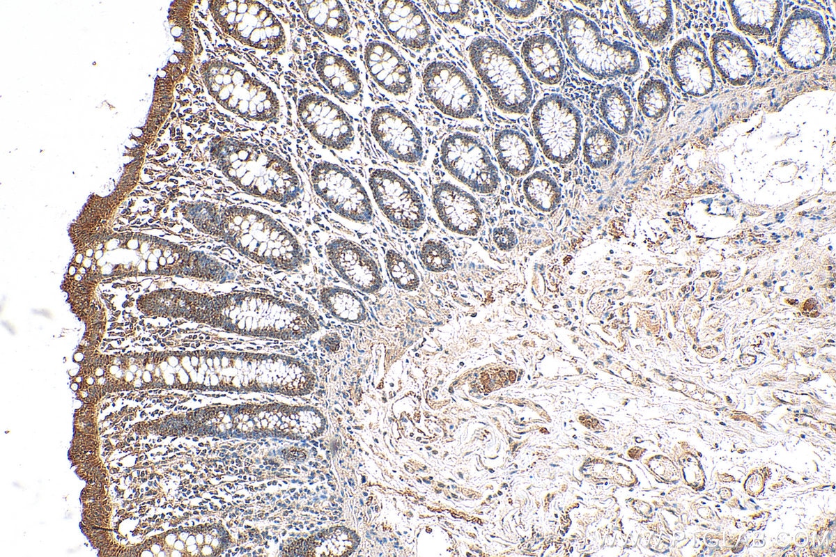 IHC staining of human colon using 21955-1-AP