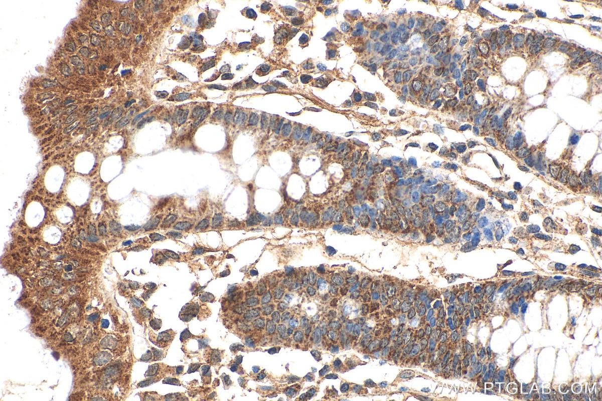 Immunohistochemistry (IHC) staining of human colon tissue using SHPRH Polyclonal antibody (21955-1-AP)