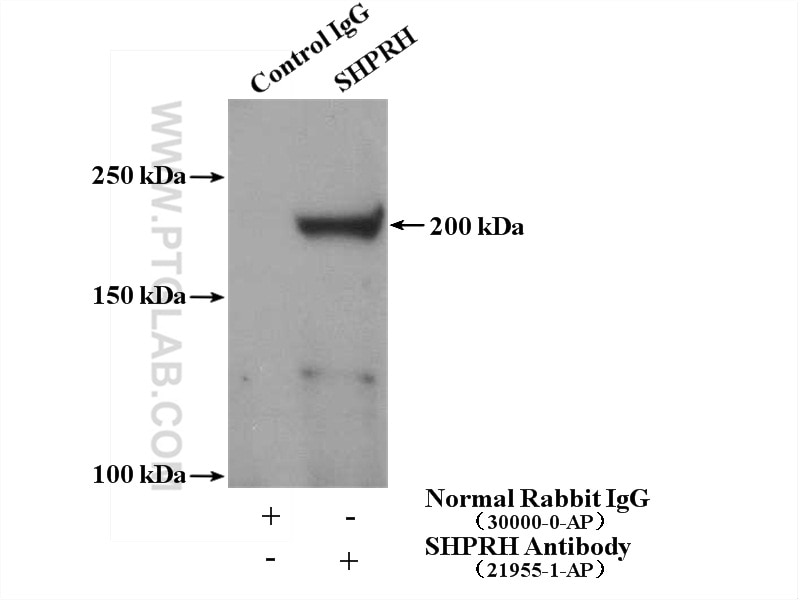 Immunoprecipitation (IP) experiment of mouse testis tissue using SHPRH Polyclonal antibody (21955-1-AP)